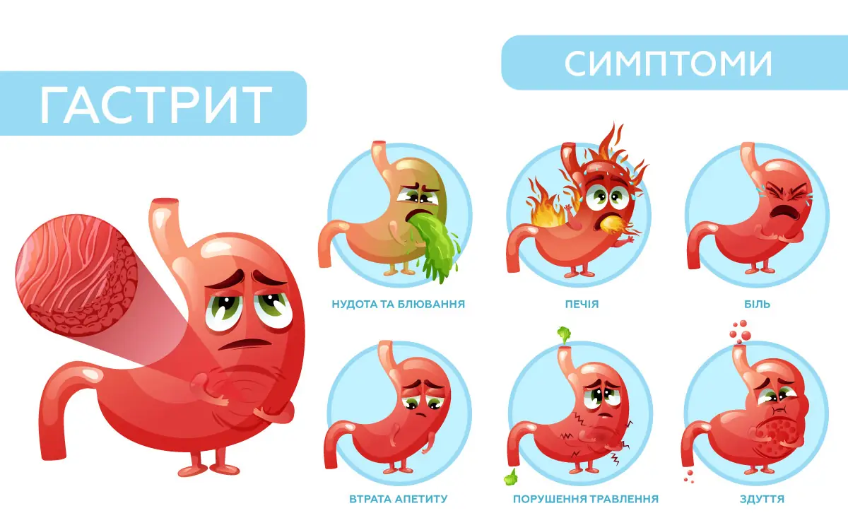 Симптоми гастриту: як розпізнати